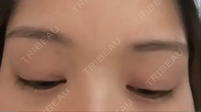 アートメイク（眉） 東京中央クリニック AFTER メイン用