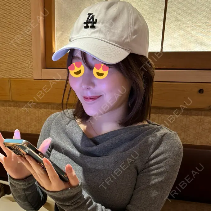 糸リフト / 脂肪吸引（顔） Tokyo Tensei Clinic 新宿院 AFTER メイン用