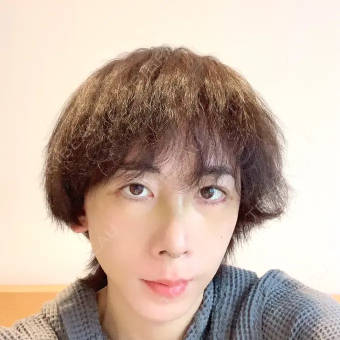 骨切り（あご） / 骨削り（エラ） / 骨削り（頬） id（アイディ）美容外科 DAY 12 メイン用