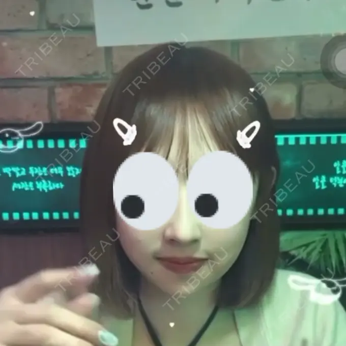 糸リフト / バッカルファット除去 / 脂肪吸引（顔） RIVER CLINIC（リバークリニック） DAY 3 メイン用