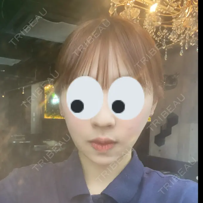 糸リフト / バッカルファット除去 / 脂肪吸引（顔） RIVER CLINIC（リバークリニック） DAY 12 メイン用