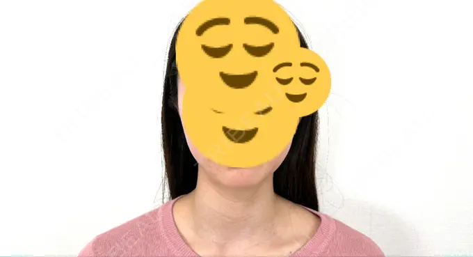 ボトックス（エラ・小顔） / ボトックス（肩） THE FIRST CLINIC 多摩センター院 DAY 10 メイン用