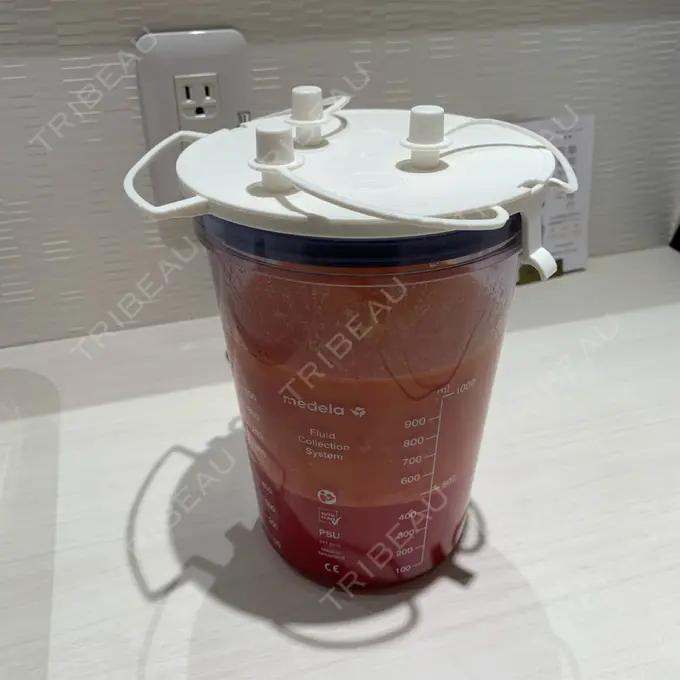 脂肪吸引（二の腕） / 脂肪吸引（肩） Mods Clinic（モッズクリニック） 名古屋院 DAY 0 メイン用