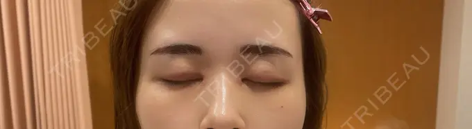 アートメイク（眉） にしまき美容スキンクリニック DAY 0 メイン用