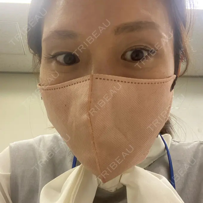 ボトックス（眉間） / ボトックス（目尻） 湘南美容クリニック 自由が丘院 AFTER メイン用