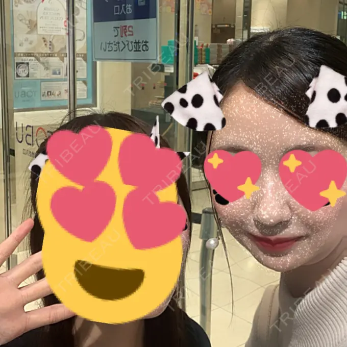 糸リフト / バッカルファット除去 / 脂肪吸引（顔） RIVER CLINIC（リバークリニック） DAY 46 メイン用