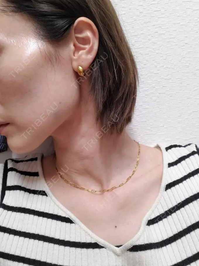 ボトックス（エラ・小顔） / ピーリング（ニキビ・毛穴） / イオン導入 ルラ美容クリニック 上野院 DAY 0 メイン用