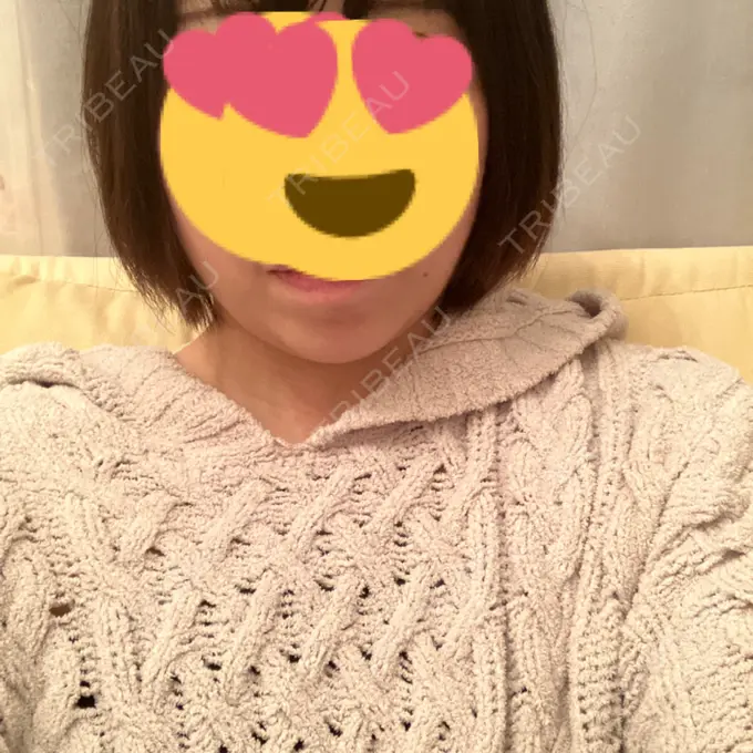 糸リフト / バッカルファット除去 / 脂肪吸引（顔） RIVER CLINIC（リバークリニック） AFTER メイン用