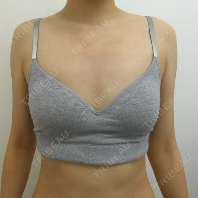 豊胸（ヒアルロン酸） 藤・ナチュレ美容クリニック 恵比寿院 DAY 0 メイン用