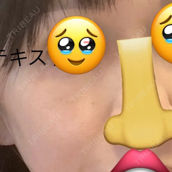 イオン導入 / ピコレーザートーニング（美白・肝斑） ルラ美容クリニック 福岡本院 AFTER メイン用