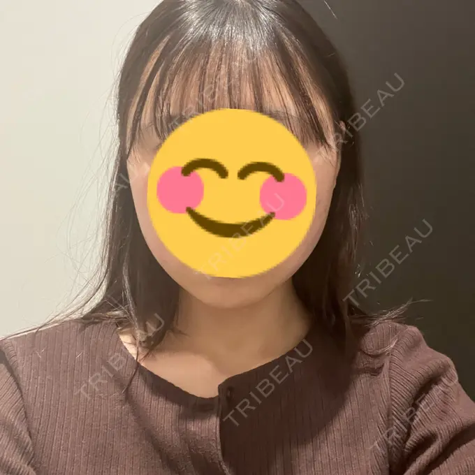 糸リフト / バッカルファット除去 / 脂肪吸引（顔） / ボトックス（エラ・小顔） RIVER CLINIC（リバークリニック） DAY 0 メイン用