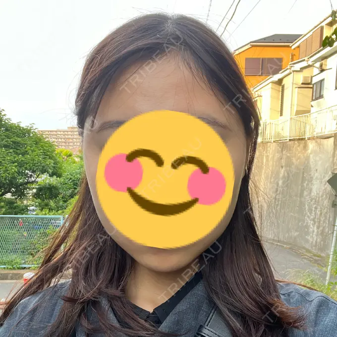 糸リフト / バッカルファット除去 / 脂肪吸引（顔） / ボトックス（エラ・小顔） RIVER CLINIC（リバークリニック） DAY 1 メイン用