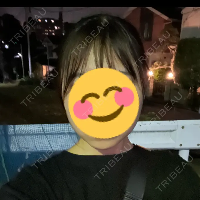 糸リフト / バッカルファット除去 / 脂肪吸引（顔） / ボトックス（エラ・小顔） RIVER CLINIC（リバークリニック） DAY 2 メイン用