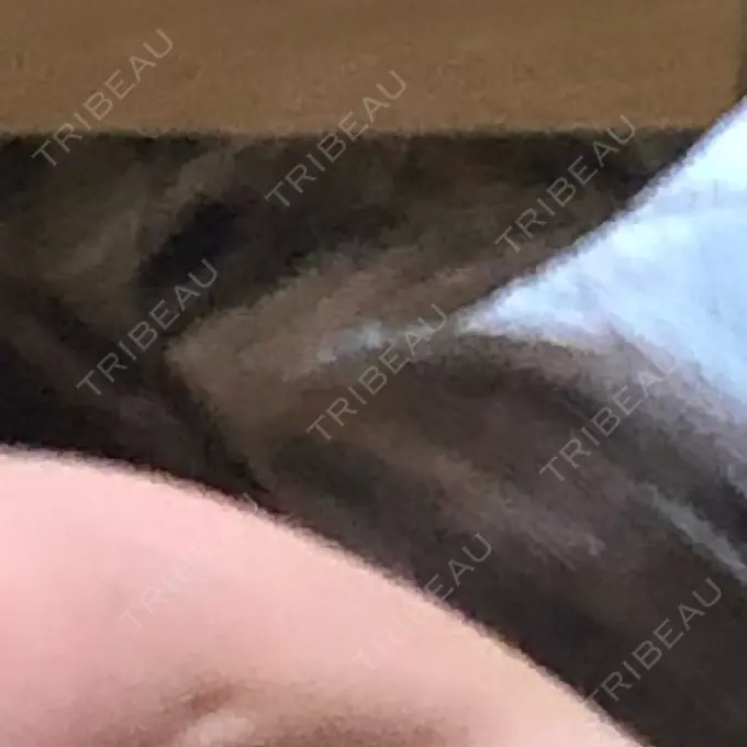 ハイフ（顔） Mavie Beauty Clinic （マヴィービューティークリニック） DAY 2 メイン用