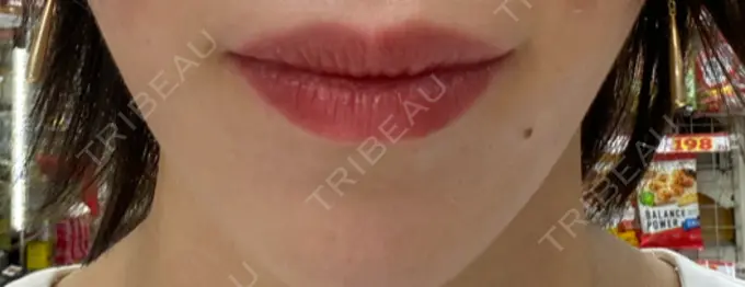 アートメイク（唇） THE ARTMAKE TOKYO 銀座院 AFTER メイン用