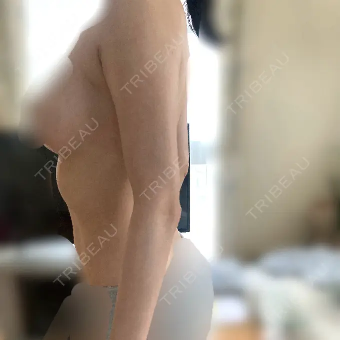 脂肪吸引（二の腕） / 脂肪吸引（脚） / 豊胸（脂肪注入） / 脂肪注入（肌） / こめかみ形成 / 脂肪吸引（肩） / 脂肪注入（目の下） / 脂肪注入（輪郭） ICON CLINIC DAY 31 メイン用