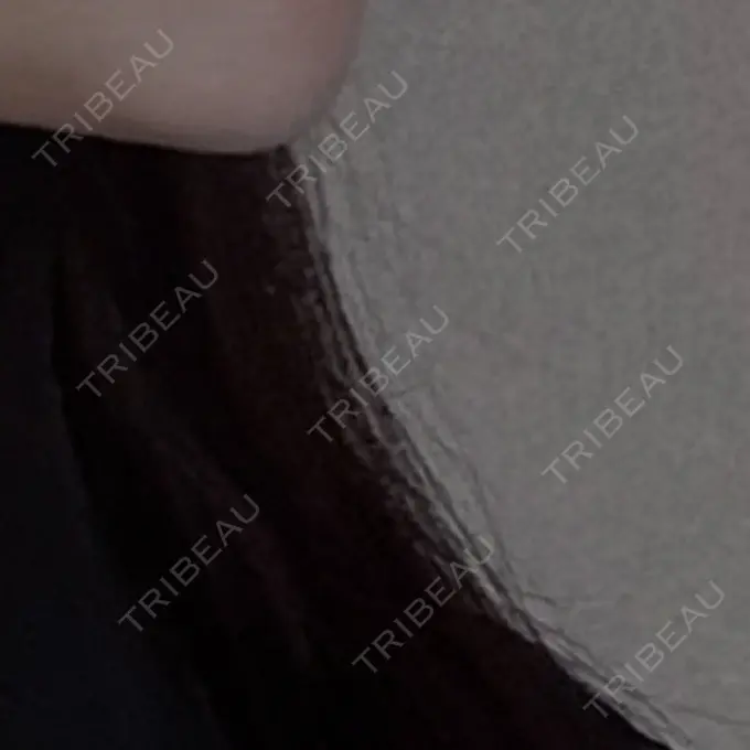 ハイフ（顔） Mavie Beauty Clinic （マヴィービューティークリニック） AFTER メイン用