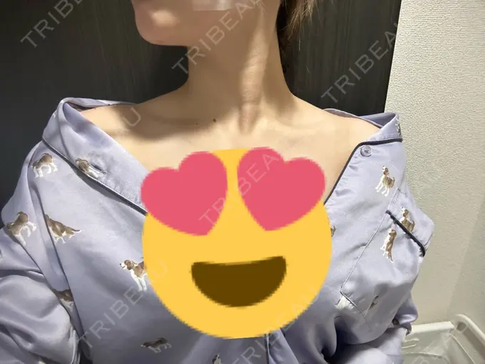 糸リフト / ヒアルロン酸注入（あご） / ボトックス（肩） TCB東京中央美容外科 心斎橋院 DAY 19 メイン用