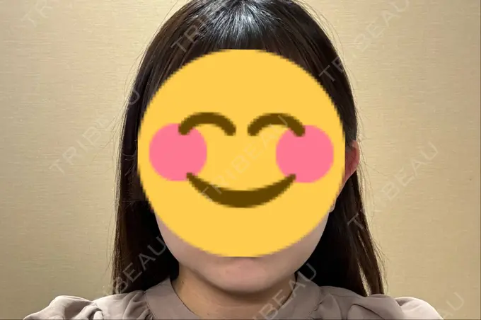 脂肪溶解注射（顔） 表参道ウィズ・クリニック DAY 2 メイン用