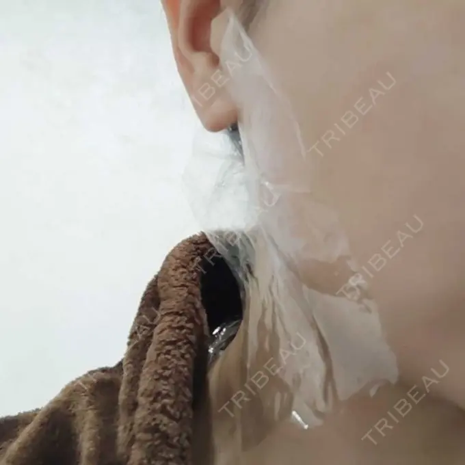 ボトックス（エラ・小顔） / ボトックス（肩） TCB東京中央美容外科 立川院 AFTER メイン用