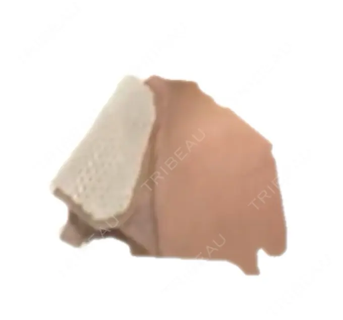 鼻中隔延長（切開） こいずみ形成クリニック名古屋 DAY 3 メイン用