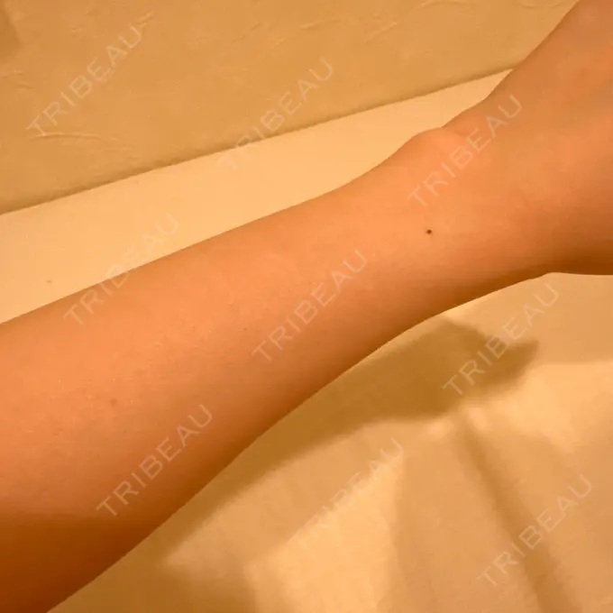 医療脱毛（全身） ジュエルクリニック 恵比寿院 DAY 8 メイン用