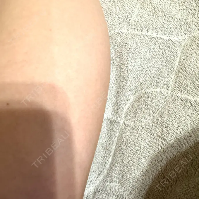 白玉点滴・注射 城本クリニック 名古屋院 AFTER メイン用