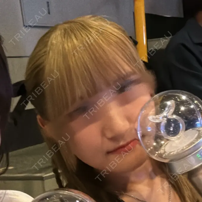 骨切り（あご） 銀座マイアミ美容外科 DAY 106 メイン用