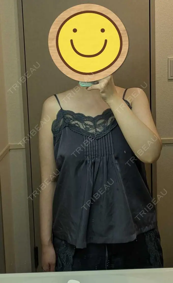 脂肪吸引（二の腕） / 脂肪吸引（肩） / その他 湘南美容クリニック 銀座院 DAY 91 メイン用