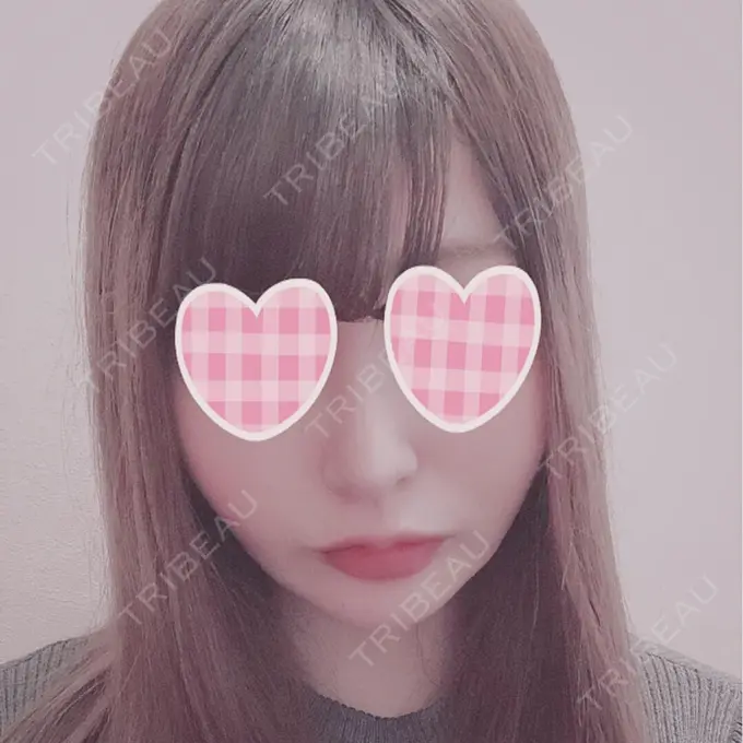 バッカルファット除去 / 脂肪吸引（顔） / ボトックス（あご） / ヒアルロン酸注入（あご） / ボトックス（エラ・小顔） / ヒアルロン酸注入（唇） / ボトックス（口角） エートップ美容整形外科 AFTER メイン用