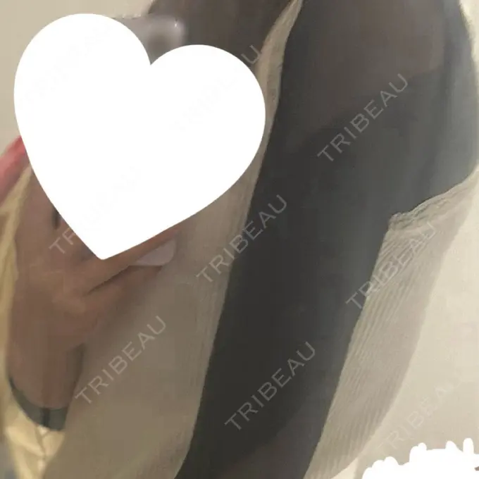 脂肪吸引（二の腕） / 脂肪吸引（肩） / その他（ボディ） ルーチェクリニック 銀座院 DAY 0 メイン用