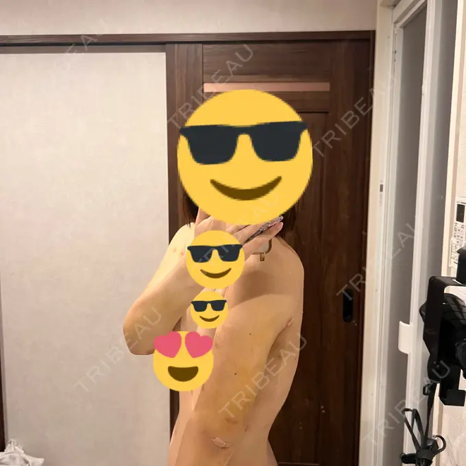 脂肪吸引（二の腕） アムルーズ美容外科クリニック 横浜院 DAY 9 メイン用