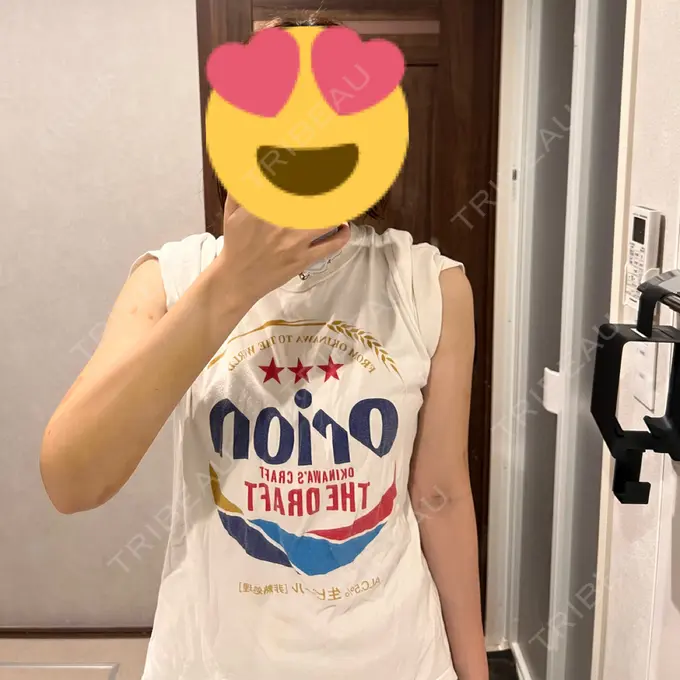 脂肪吸引（二の腕） アムルーズ美容外科クリニック 横浜院 DAY 11 メイン用