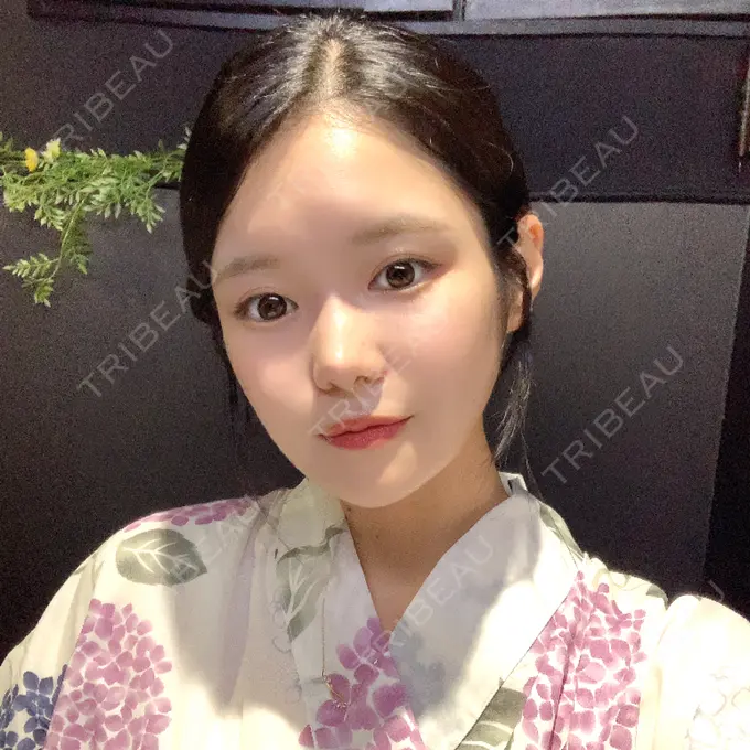 骨切り（あご） / 骨削り（エラ） / 骨削り（頬） id（アイディ）美容外科 DAY 209 メイン用