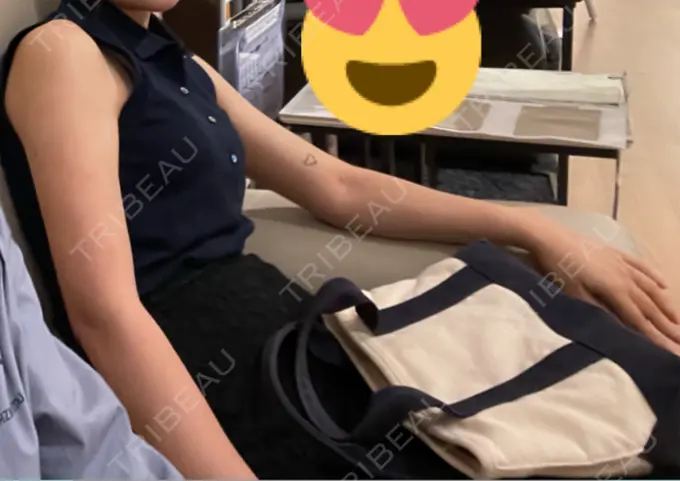 脂肪吸引（二の腕） アムルーズ美容外科クリニック 横浜院 AFTER メイン用