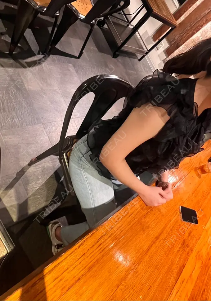 糸リフト / バッカルファット除去 / 脂肪吸引（顔） / 脂肪吸引（二の腕） 湘南美容クリニック 京都院 AFTER メイン用