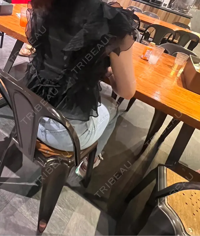 糸リフト / バッカルファット除去 / 脂肪吸引（顔） / 脂肪吸引（二の腕） 湘南美容クリニック 京都院 DAY 91 メイン用