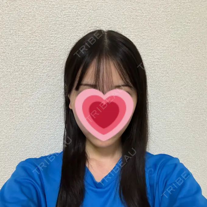 糸リフト / 脂肪吸引（顔） / ボトックス（エラ・小顔） RIVER CLINIC（リバークリニック） DAY 16 メイン用