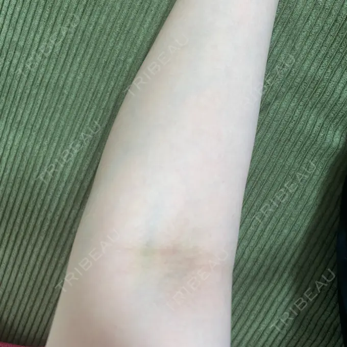 白玉点滴・注射 城本クリニック 池袋院 AFTER メイン用