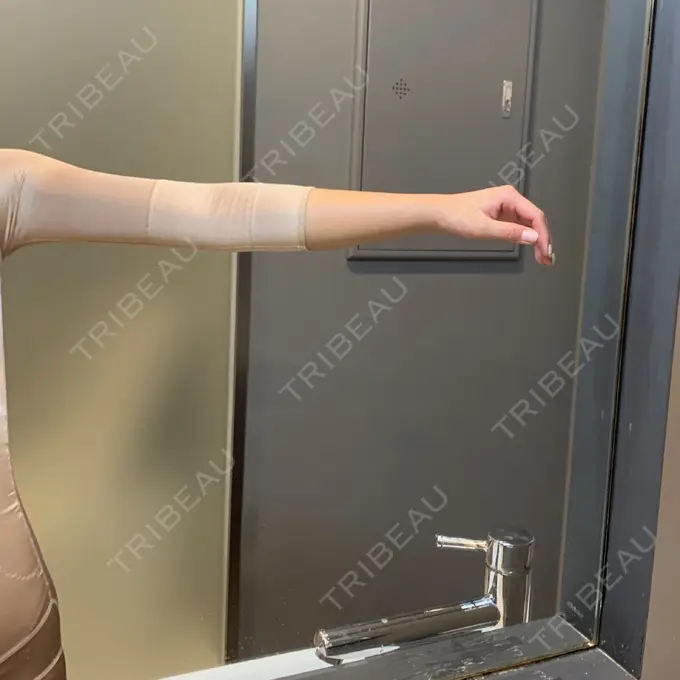 脂肪吸引（二の腕） / 脂肪吸引（お腹） ドクターフィット（Dr.fit）クリニック DAY 3 メイン用