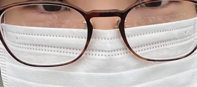 下まぶたの脂肪取り 吉井クリニック DAY 1 メイン用