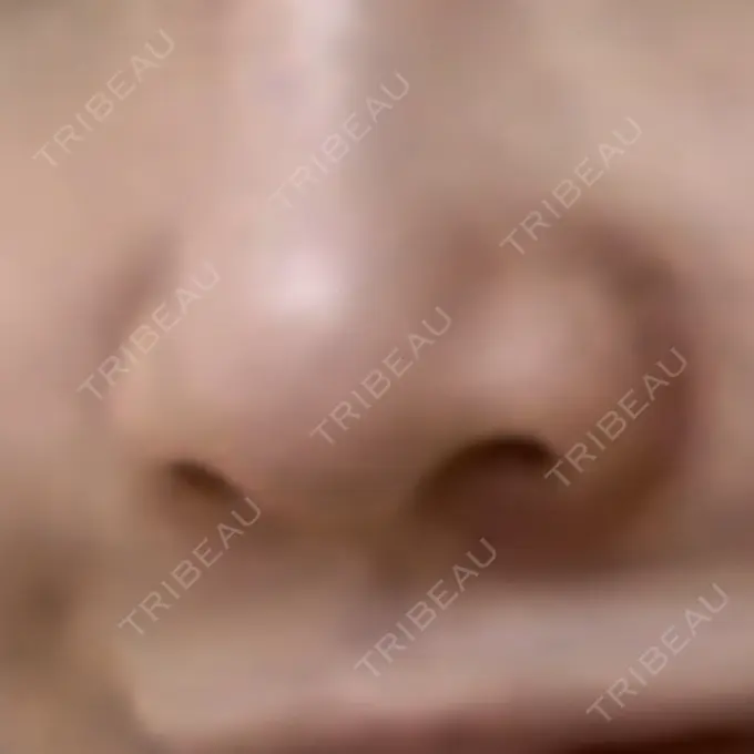 その他（鼻） LE CLINIC DAY 39 メイン用