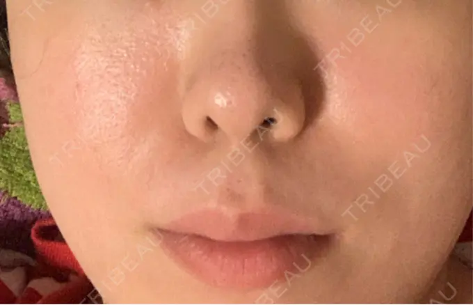 レーザーフェイシャル LIGHT CLINIC 【ライトクリニック】 新宿院 DAY 0 メイン用