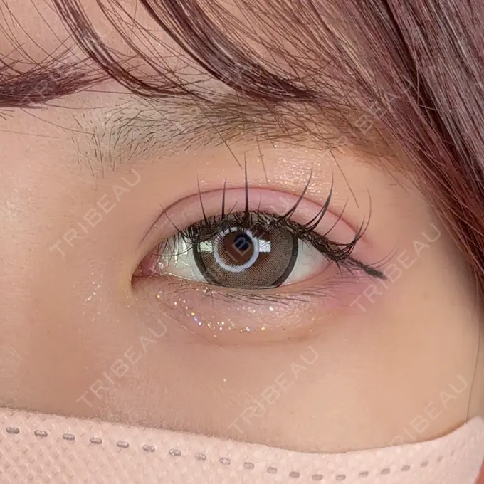 二重埋没 アリエル美容クリニック 郡山院 AFTER メイン用