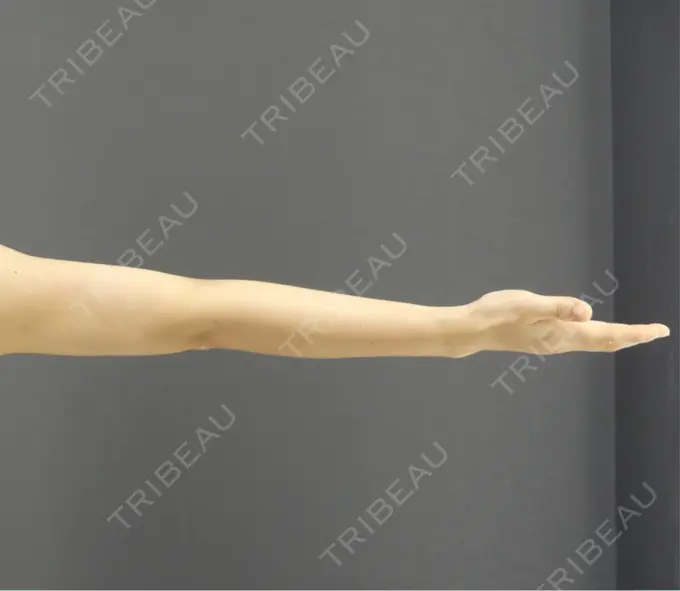 脂肪吸引（二の腕） / 脂肪吸引（肩） GRACIA clinic 【グラシアクリニック】 DAY 31 メイン用