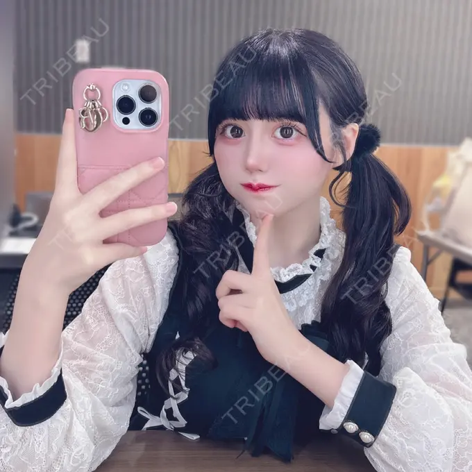 脂肪吸引（顔） / ジョールファット除去 R Beauty CLINIC 銀座院 AFTER メイン用