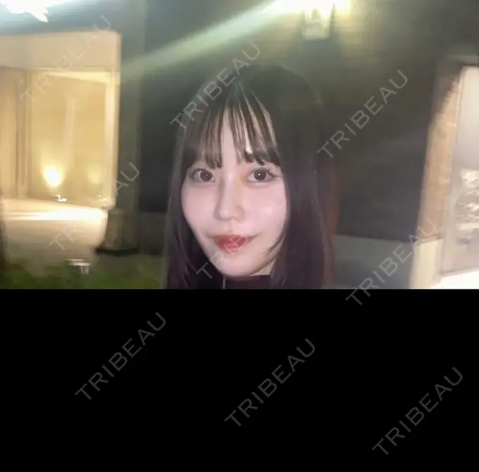 糸リフト / 脂肪吸引（顔） / ボトックス（エラ・小顔） RIVER CLINIC（リバークリニック） AFTER メイン用