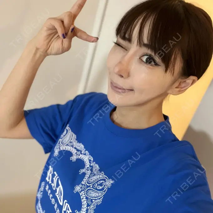 隆鼻術 / 糸リフト / 軟骨移植 / 脂肪注入（肌） / プロテーゼ除去 / 鼻修正 / 脂肪注入（額） / 脂肪注入（目の下） / その他（肌） id（アイディ）美容外科 DAY 135 メイン用