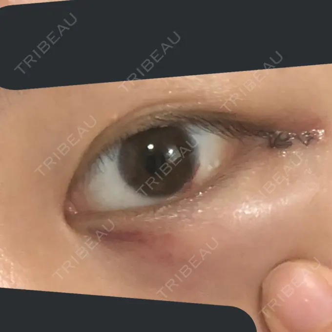 バッカルファット除去 / 脂肪吸引（顔） / 目尻切開 / 水光注射（ハリ・美肌） / ヒアルロン酸注入（あご） / ボトックス（エラ・小顔） / ボトックス（口角） / 白玉点滴・注射 / その他（肌） エートップ美容整形外科 DAY 2 メイン用