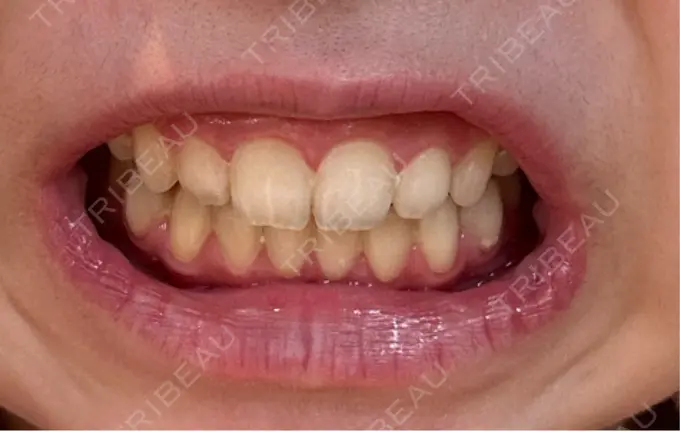 ホワイトニング LEAGRANT CLINIC 中目黒 DAY 31 メイン用